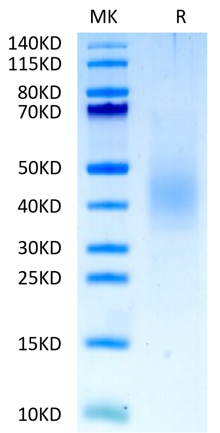 Biotinylated Human FGFR2 beta (IIIb) Domain on Tris-Bis PAGE under reduced condition. The purity is greater than 95%.Biotinylated Human FGFR2 beta (IIIb) Domain Protein, Active