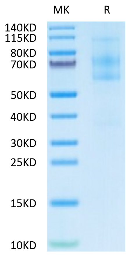 Mouse EFEMP1 on Tris-Bis PAGE under reduced condition. The purity is greater than 95%.Recombinant Mouse EFEMP1 Protein