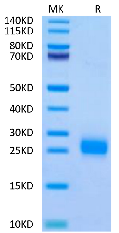 Human FSHB on Tris-Bis PAGE under reduced condition. The purity is greater than 95%.Recombinant Human FSHB Protein