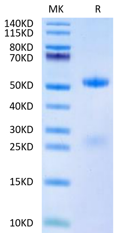 Human FSH alpha&beta on Tris-Bis PAGE under reduced condition. The purity is greater than 95%.Recombinant Human FSH alphaβ Protein
