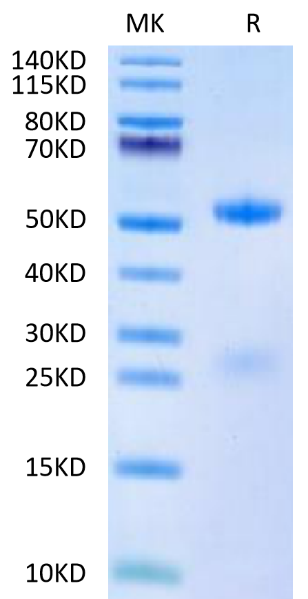 Human FSH alpha&beta on Tris-Bis PAGE under reduced condition. The purity is greater than 95%.Recombinant Human FSH alphaβ Protein
