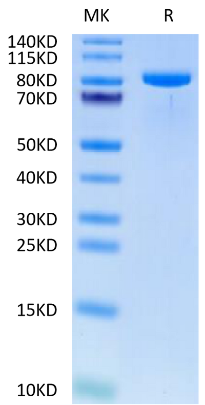 Human TIE1 on Tris-Bis PAGE under reduced condition. The purity is greater than 95%.Recombinant Human TIE1 Protein