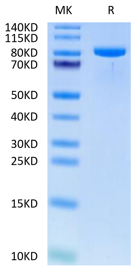 Human TIE1 on Tris-Bis PAGE under reduced condition. The purity is greater than 95%.Recombinant Human TIE1 Protein