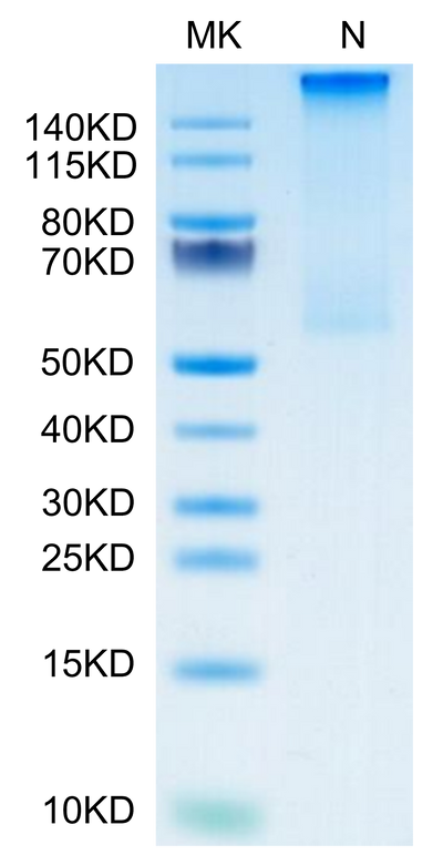 Cynomolgus HLA-G&B2M&Peptide (RIIPRHLQL) Tetramer on Tris-Bis PAGE under Non reducing (N) condition. The purity is greater than 95%.Recombinant Cynomolgus HLA-G&B2M&Peptide (RIIPRHLQL) Tetramer Protein, Active
