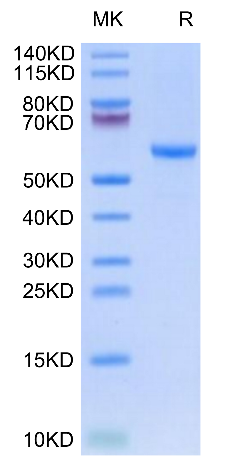 Rhesus macaque HLA-G&B2M&Peptide (RIIPRHLQL) Monomer on Tris-Bis PAGE under reduced condition. The purity is greater than 95%.Recombinant Rhesus macaque HLA-G&B2M&Peptide (RIIPRHLQL) Monomer Protein, Active