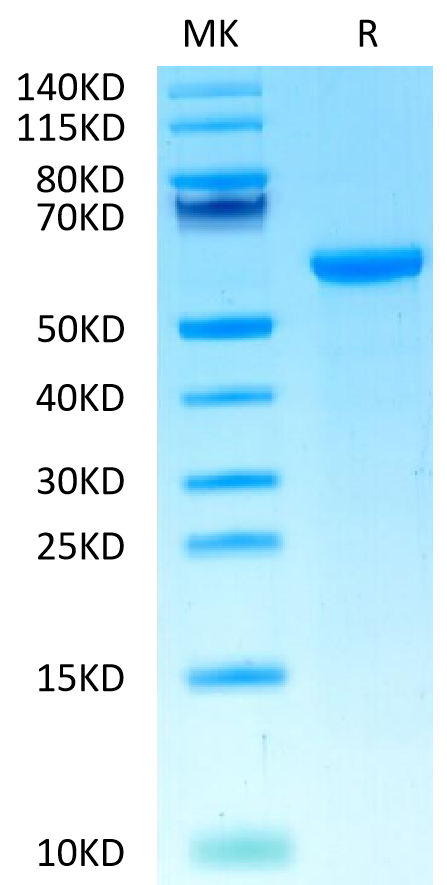 Biotinylated Cynomolgus HLA-G&B2M&Peptide (RIIPRHLQL) Monomer on Tris-Bis PAGE under reduced condition. The purity is greater than 95%.Biotinylated Cynomolgus HLA-G&B2M&Peptide (RIIPRHLQL) Monomer Protein, Active