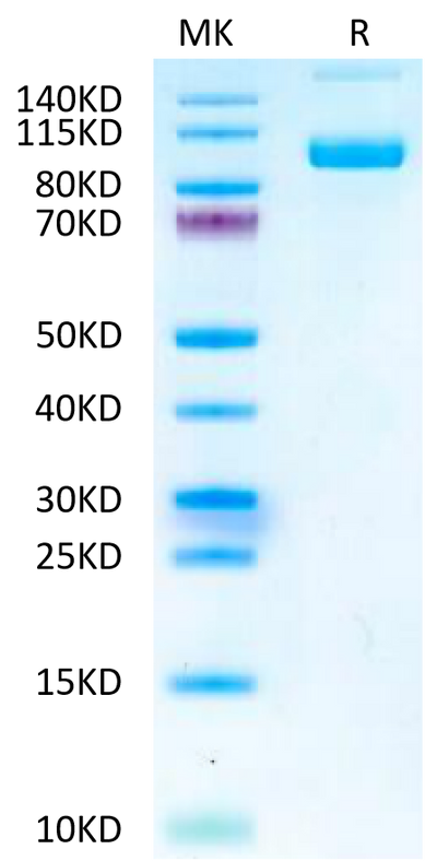 Mouse PSMA on Tris-Bis PAGE under reduced condition. The purity is greater than 95%.Recombinant Mouse PSMA/FOLH1 Protein