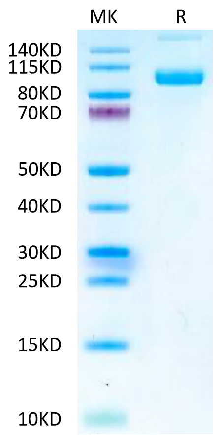 Mouse PSMA on Tris-Bis PAGE under reduced condition. The purity is greater than 95%.Recombinant Mouse PSMA/FOLH1 Protein