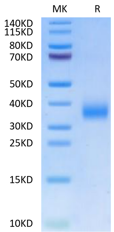 Human CD72 on Tris-Bis PAGE under reduced condition. The purity is greater than 95%.Recombinant Human CD72 Protein