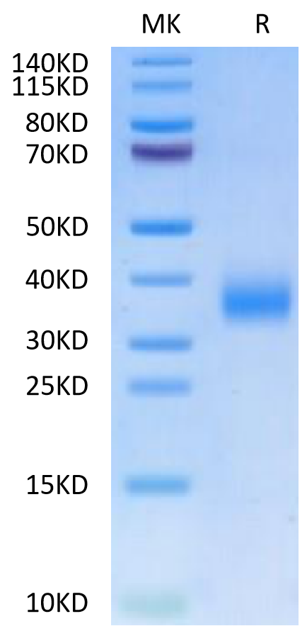 Human CD72 on Tris-Bis PAGE under reduced condition. The purity is greater than 95%.Recombinant Human CD72 Protein