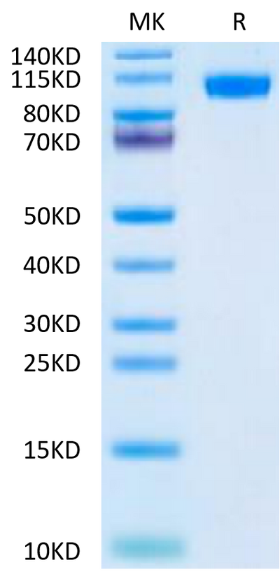 Mouse NCAM-1 on Tris-Bis PAGE under reduced condition. The purity is greater than 95%.Recombinant Mouse NCAM-1/CD56 Protein
