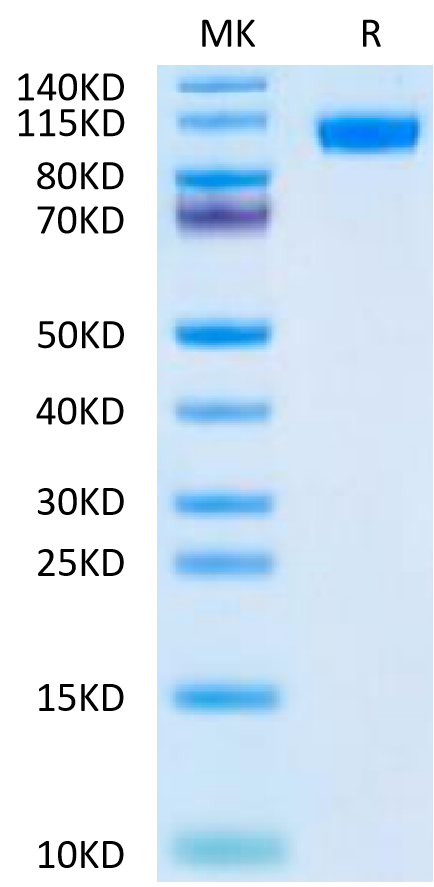 Mouse NCAM-1 on Tris-Bis PAGE under reduced condition. The purity is greater than 95%.Recombinant Mouse NCAM-1/CD56 Protein