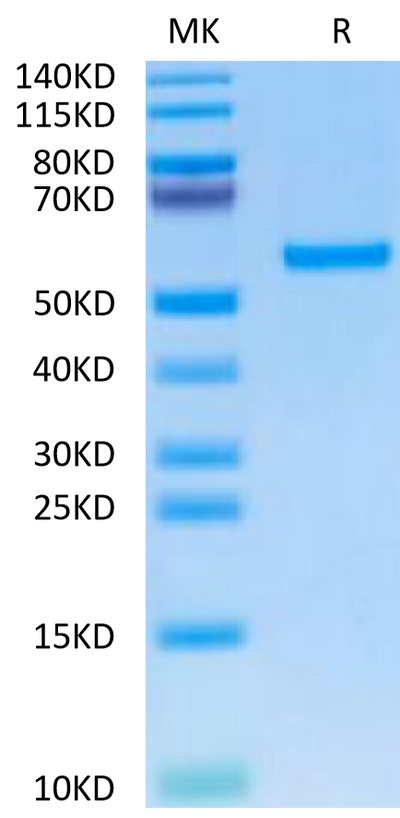 Cynomolgus ROR2 on Tris-Bis PAGE under reduced condition. The purity is greater than 95%.Recombinant Cynomolgus ROR2/NTRKR2 Protein, Active