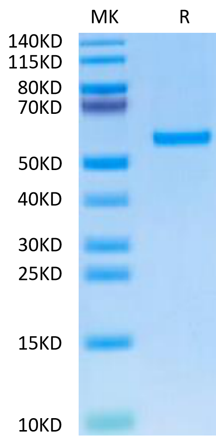 Cynomolgus ROR2 on Tris-Bis PAGE under reduced condition. The purity is greater than 95%.Recombinant Cynomolgus ROR2/NTRKR2 Protein, Active