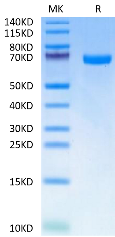 Human EphA7 on Tris-Bis PAGE under reduced condition. The purity is greater than 95%.Recombinant Human EphA7 Protein, Active