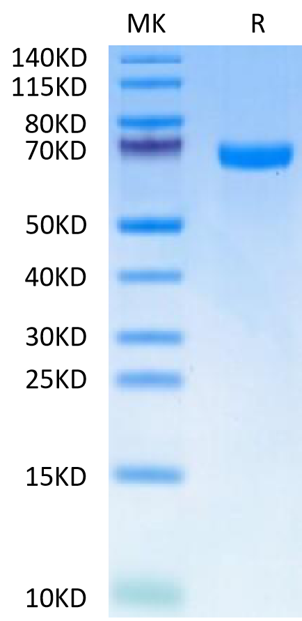 Human EphA7 on Tris-Bis PAGE under reduced condition. The purity is greater than 95%.Recombinant Human EphA7 Protein, Active