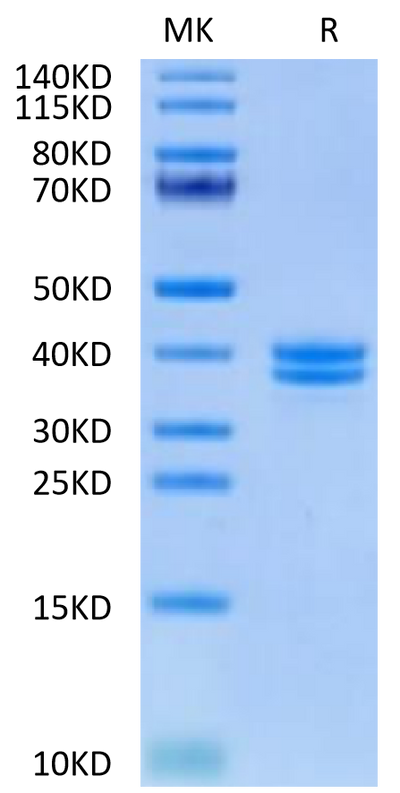 Human IGFII on Tris-Bis PAGE under reduced condition. The purity is greater than 95%.Recombinant Human IGFII Protein, Active