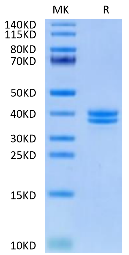 Human IGFII on Tris-Bis PAGE under reduced condition. The purity is greater than 95%.Recombinant Human IGFII Protein, Active