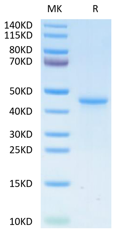 Human LY6G6D on Tris-Bis PAGE under reduced condition. The purity is greater than 95%.Recombinant Human LY6G6D Protein, Active