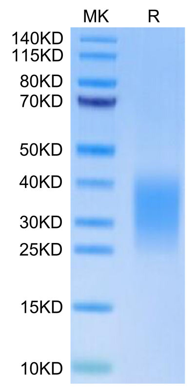 Human Activin RIIB on Tris-Bis PAGE under reduced condition. The purity is greater than 95%.Recombinant Human Activin RIIB/ACVR2B Protein, Active