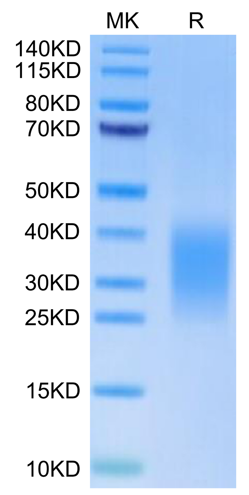 Human Activin RIIB on Tris-Bis PAGE under reduced condition. The purity is greater than 95%.Recombinant Human Activin RIIB/ACVR2B Protein, Active