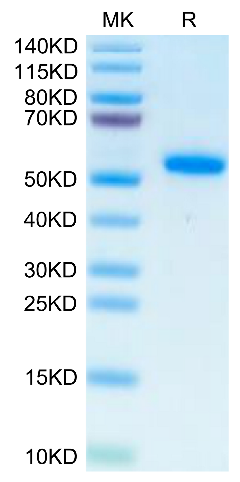 Human IL-17B on Tris-Bis PAGE under reduced condition. The purity is greater than 95%.Recombinant Human IL-17B Protein, Active