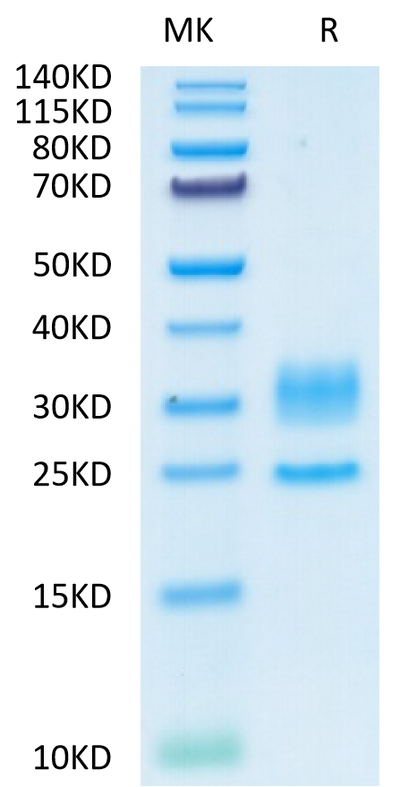 Human CD3E&CD3D on Tris-Bis PAGE under reduced condition. The purity is greater than 95%.Recombinant Human CD3E&CD3D/CD3 epsilon&CD3 delta Protein, Active