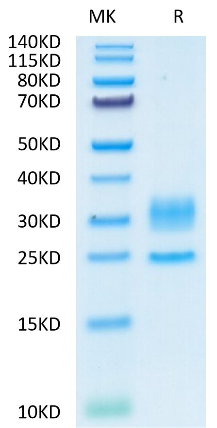 Human CD3E&CD3D on Tris-Bis PAGE under reduced condition. The purity is greater than 95%.Recombinant Human CD3E&CD3D/CD3 epsilon&CD3 delta Protein, Active