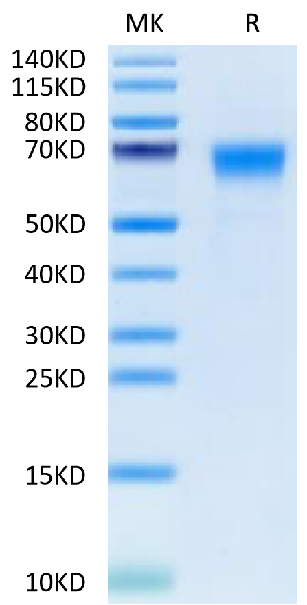 Cynomolgus B7-H7 on Tris-Bis PAGE under reduced condition. The purity is greater than 95%.Recombinant Cynomolgus B7-H7/HHLA2 Protein, Active