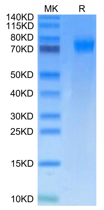 Mouse PDGF R alpha on Tris-Bis PAGE under reduced condition. The purity is greater than 95%.Recombinant Mouse PDGF R alpha/PDGFRA Protein