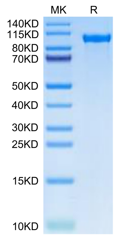 Human TIE2 on Tris-Bis PAGE under reduced condition. The purity is greater than 95%.Recombinant Human TIE2 Protein, Active