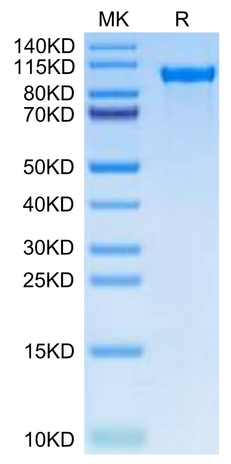 Human TIE2 on Tris-Bis PAGE under reduced condition. The purity is greater than 95%.Recombinant Human TIE2 Protein, Active
