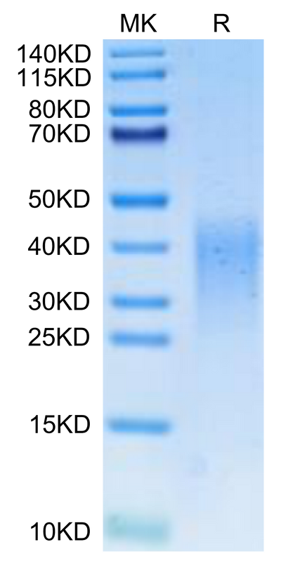 Mouse Activin RIIB on Tris-Bis PAGE under reduced condition. The purity is greater than 95%.Recombinant Mouse Activin RIIB/ACVR2B Protein, Active