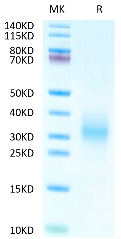 Human CD37 on Tris-Bis PAGE under reduced condition. The purity is greater than 95%.Recombinant Human CD37 Protein