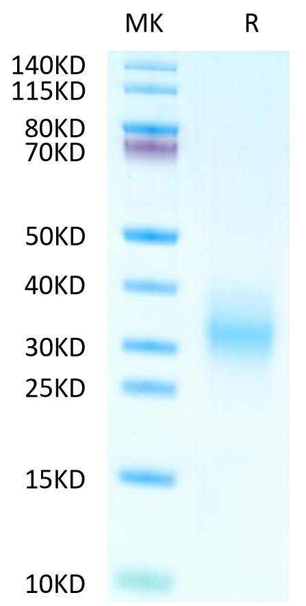 Human CD37 on Tris-Bis PAGE under reduced condition. The purity is greater than 95%.Recombinant Human CD37 Protein