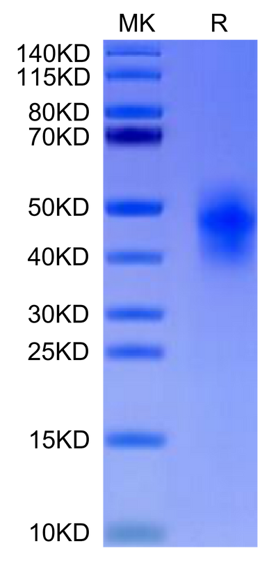 Human CD300c on Tris-Bis PAGE under reduced condition. The purity is greater than 95%.Recombinant Human CD300c/LMIR2-Protein