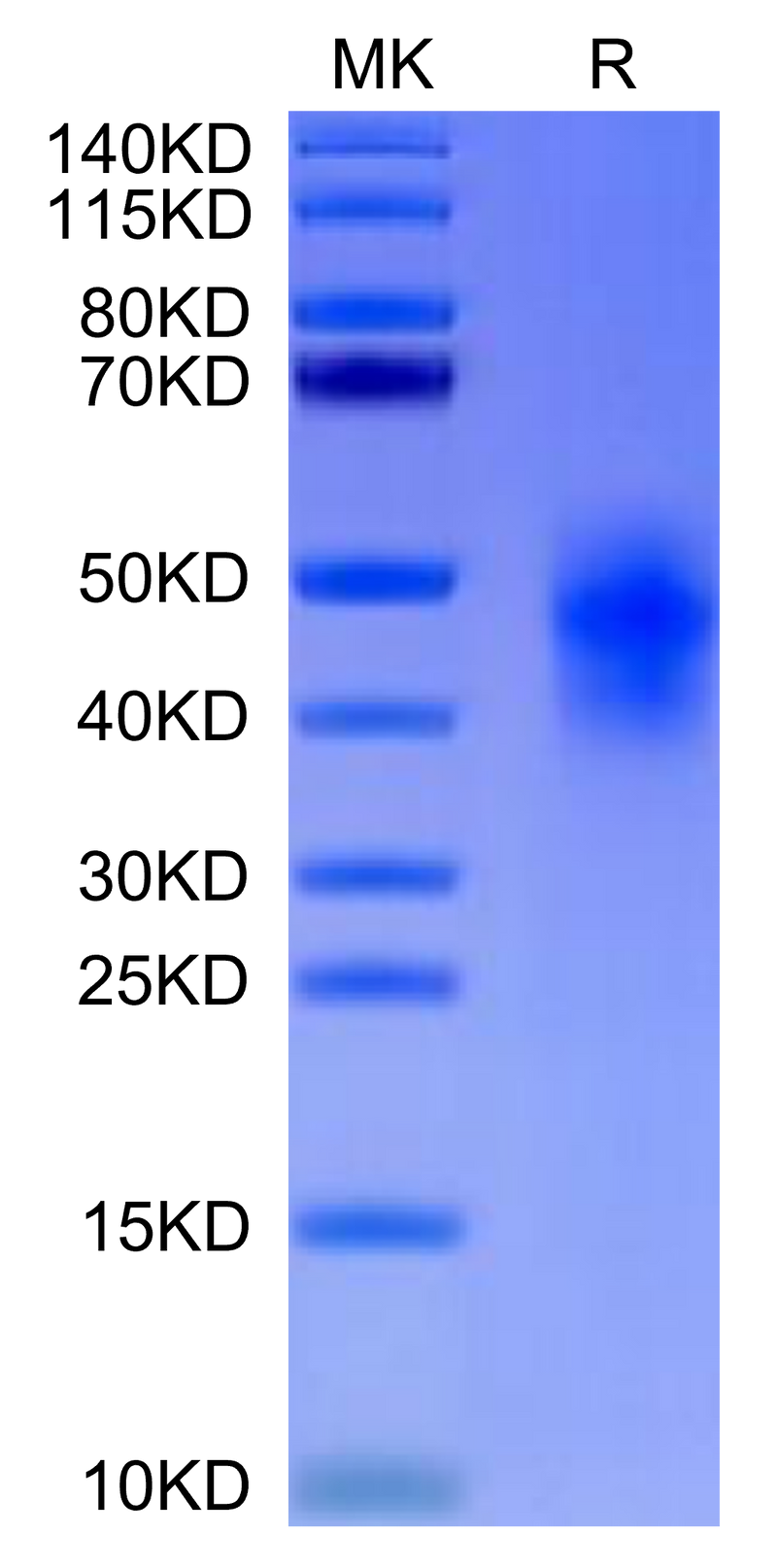 Human CD300c on Tris-Bis PAGE under reduced condition. The purity is greater than 95%.Recombinant Human CD300c/LMIR2-Protein