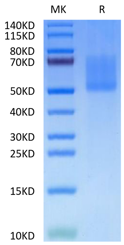 Biotinylated Human MADCAM1 on Tris-Bis PAGE under reduced condition. The purity is greater than 95%.Biotinylated Human MADCAM1 Protein, Active