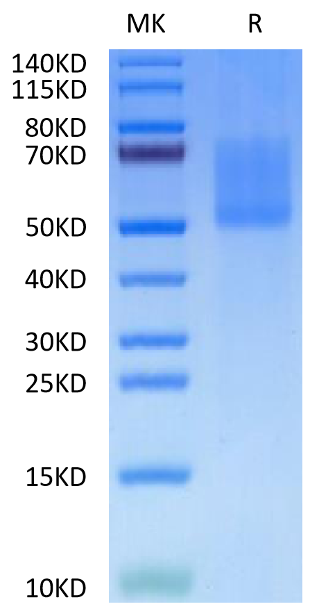 Biotinylated Human MADCAM1 on Tris-Bis PAGE under reduced condition. The purity is greater than 95%.Biotinylated Human MADCAM1 Protein, Active