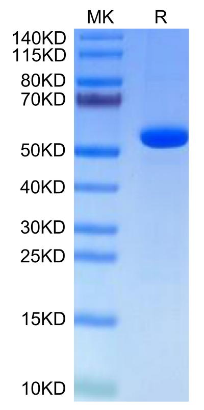 Human Hyaluronidase 2 on Tris-Bis PAGE under reduced condition. The purity is greater than 95%.Recombinant Human Hyaluronidase 2/HYAL2-Protein