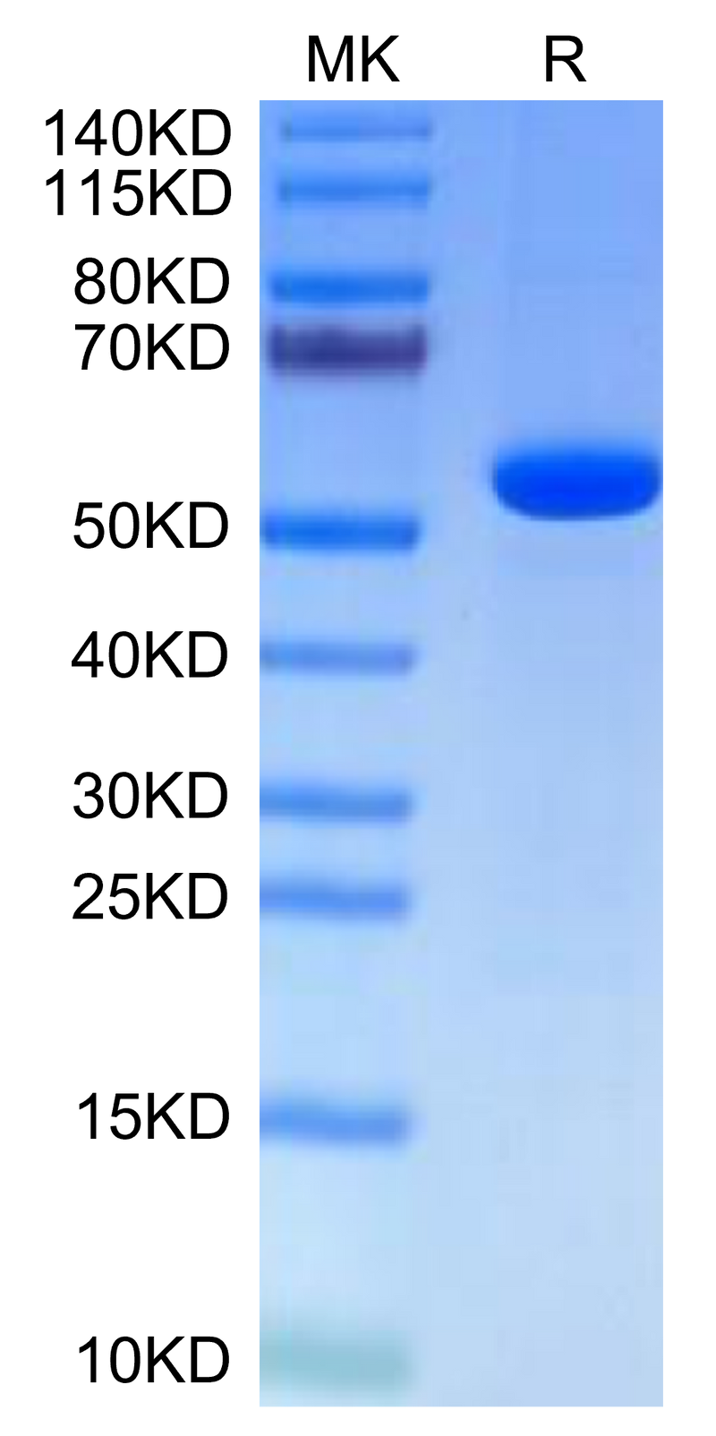 Human Hyaluronidase 2 on Tris-Bis PAGE under reduced condition. The purity is greater than 95%.Recombinant Human Hyaluronidase 2/HYAL2-Protein