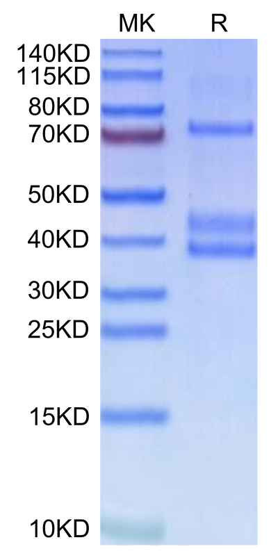 Human MSPR on Tris-Bis PAGE under reduced condition. The purity is greater than 95%.Recombinant Human MSPR/Ron-Protein