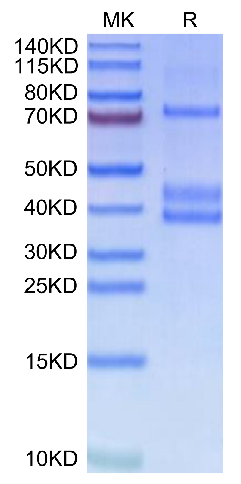 Human MSPR on Tris-Bis PAGE under reduced condition. The purity is greater than 95%.Recombinant Human MSPR/Ron-Protein