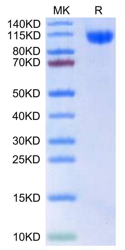Human RET-on Tris-Bis PAGE under reduced condition. The purity is greater than 95%.Recombinant Human RET-Protein