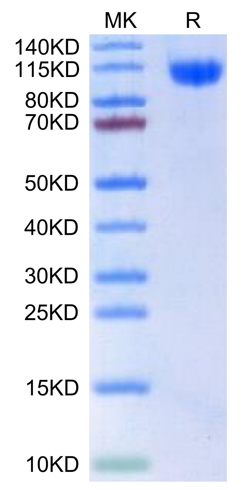 Human RET-on Tris-Bis PAGE under reduced condition. The purity is greater than 95%.Recombinant Human RET-Protein