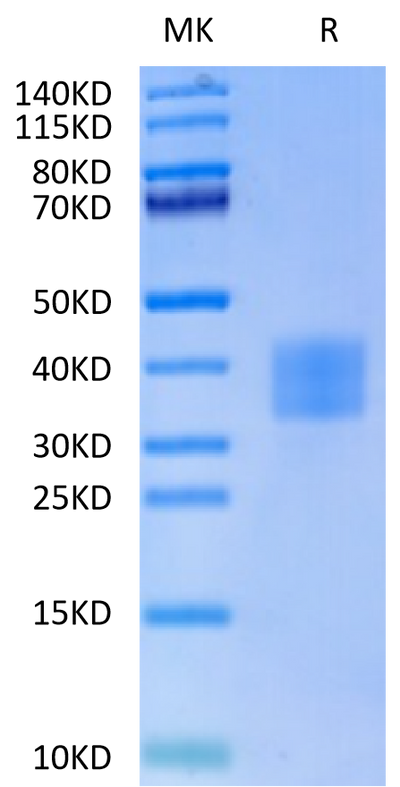 Human CD7 on Tris-Bis PAGE under reduced condition. The purity is greater than 95%.Recombinant Human CD7 Protein, Active