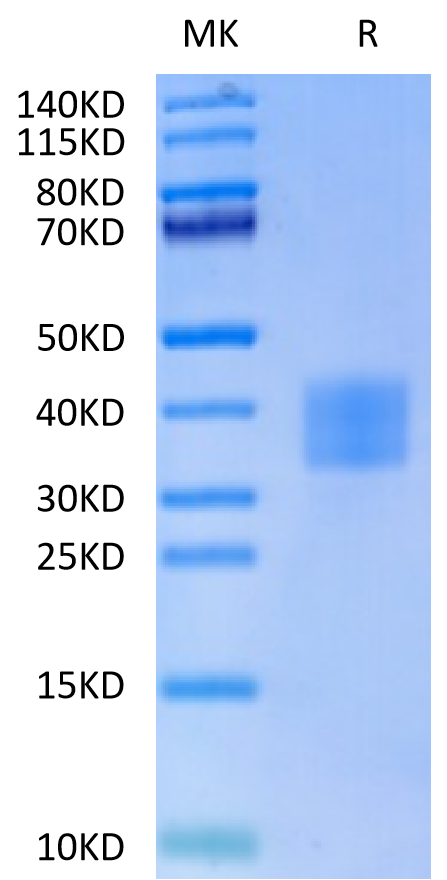 Human CD7 on Tris-Bis PAGE under reduced condition. The purity is greater than 95%.Recombinant Human CD7 Protein, Active