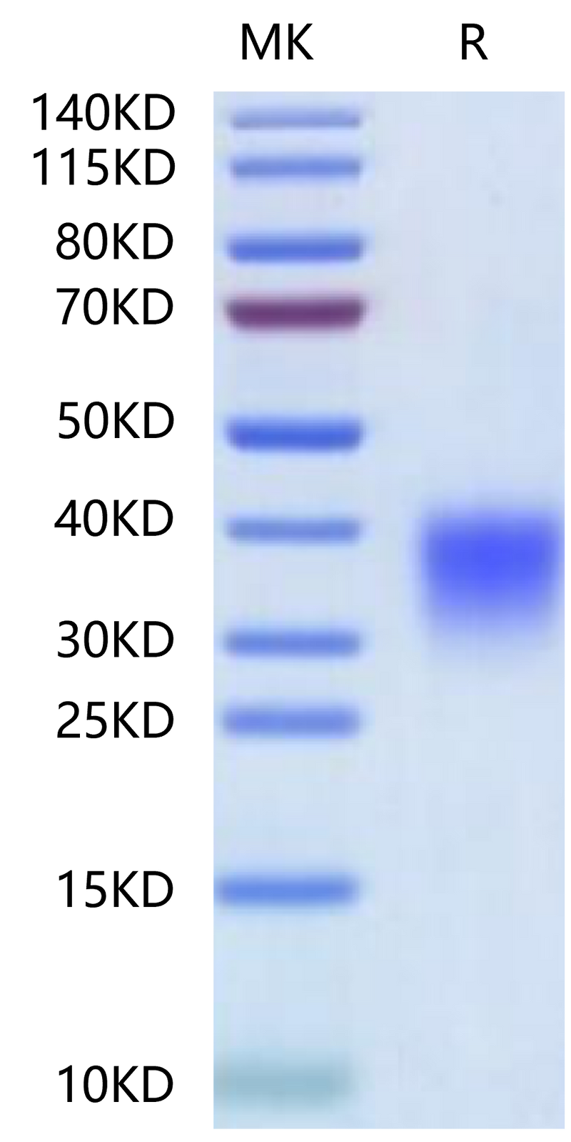 Human Activin RIIA on Tris-Bis PAGE under reduced condition. The purity is greater than 95%.Recombinant Human Activin RIIA/ACVR2A-Protein, Active