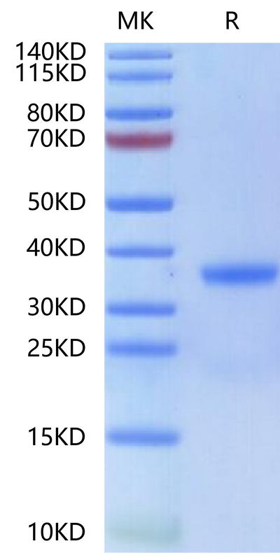 Human Kallikrein 3 on Tris-Bis PAGE under reduced condition. The purity is greater than 95%.Recombinant Human Kallikrein 3/PSA-Protein