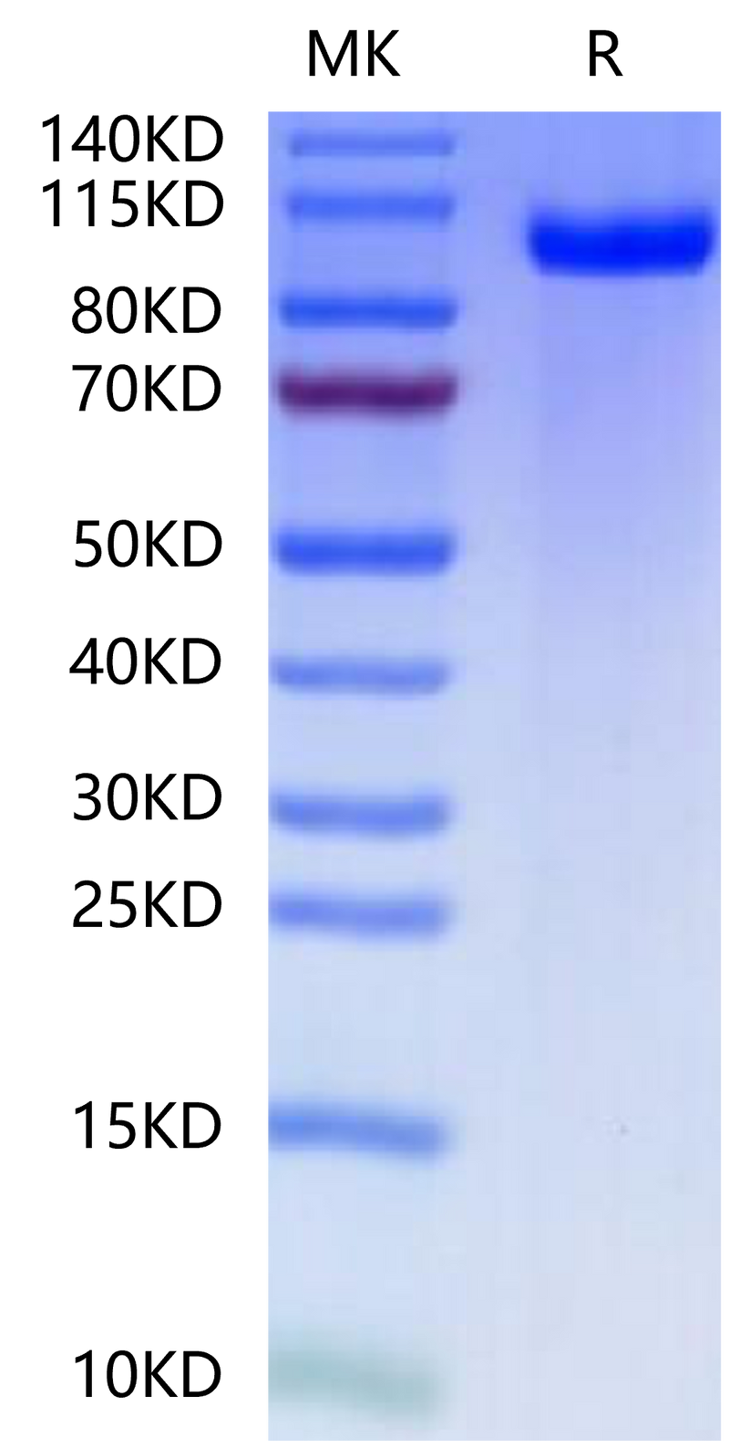 Mouse PTK7 on Tris-Bis PAGE under reduced condition. The purity is greater than 95%.Recombinant Mouse PTK7/CCK4 Protein